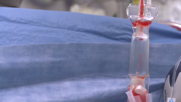 Капельница крови во время операции — стоковое видео