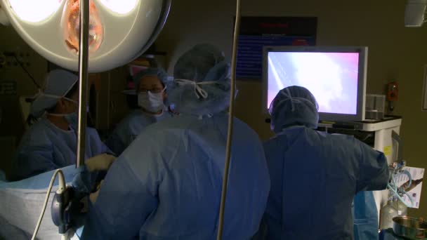 Команда хирургов проводит лапароскопию — стоковое видео