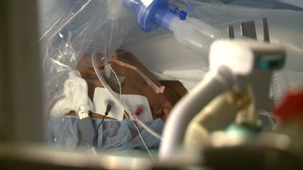 Хирургический пациент лежит на больничной койке — стоковое видео