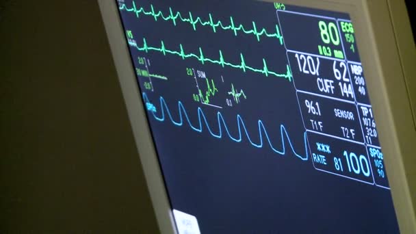 Monitor de sinais vitais durante a cirurgia — Vídeo de Stock