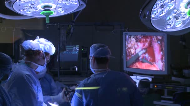 外科医生执行一次医疗手术 — 图库视频影像