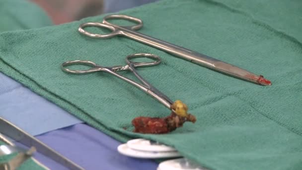 Кусок хряща на хирургическом подносе — стоковое видео