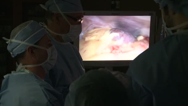 Команда хирургов проводит лапароскопию — стоковое видео