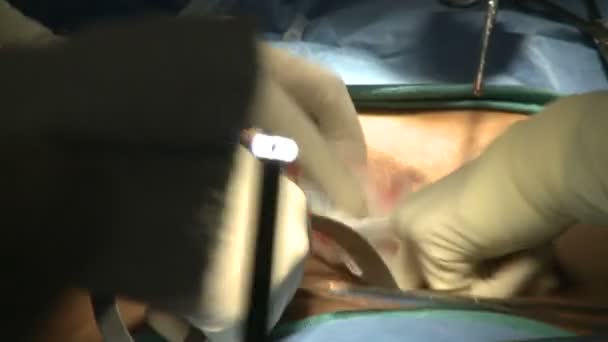 Mains au travail pendant la chirurgie laparascopique — Video