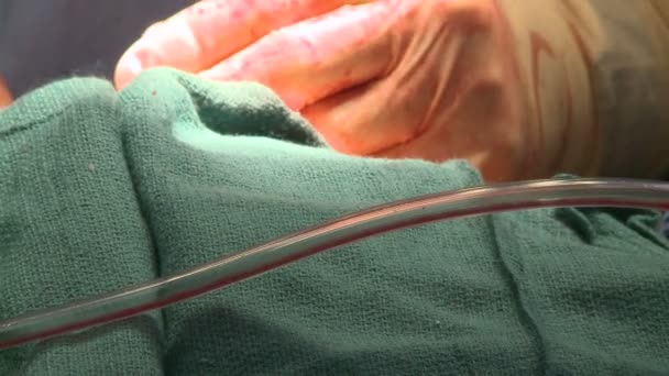 Side view of surgeon stitching patient — Stock Video