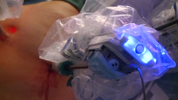 Una vista del trabajo dentro de una unidad quirúrgica robótica — Vídeo de stock