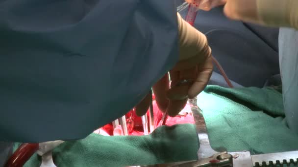 Surgeon's handen tijdens operatie — Stockvideo