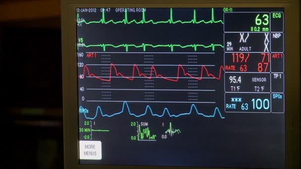 Signos vitales en el monitor médico — Vídeo de stock