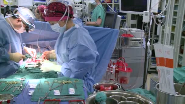 Equipe cirúrgica durante a operação — Vídeo de Stock
