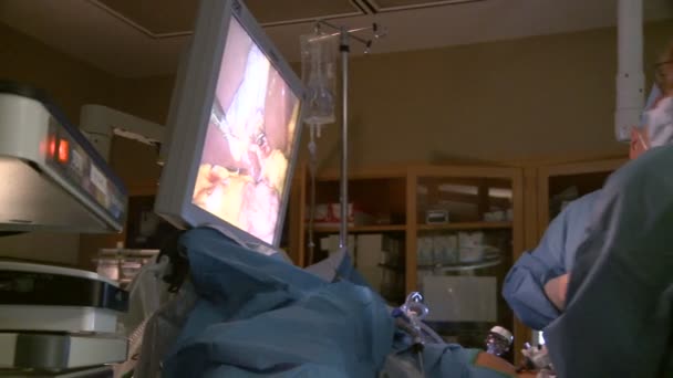 Surgeons performing operation — Stock Video