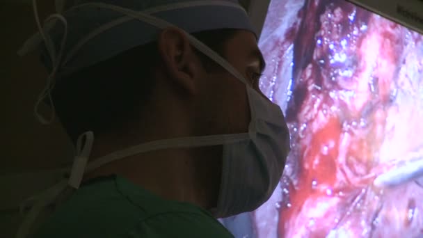 Chirurgiens effectuant une chirurgie laparoscopique — Video