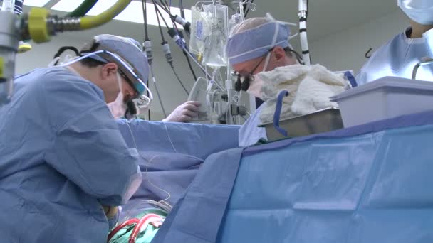 Doctors performing open heart surgery — Stock Video