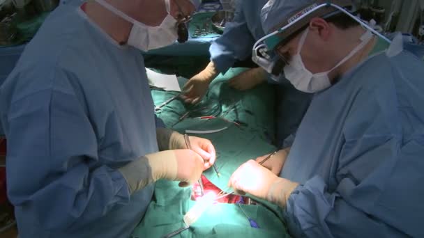 Chirurgiens effectuant une opération médicale — Video