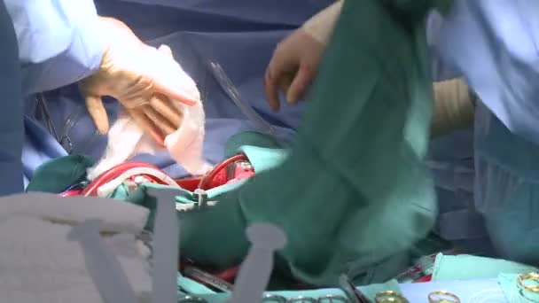 Chirurg ociera się rękawice — Wideo stockowe