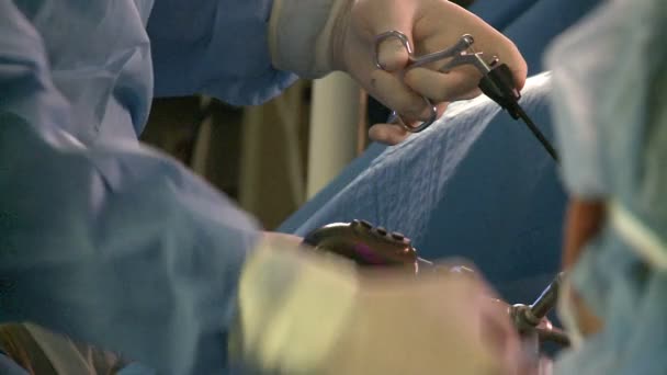 Manos en el trabajo durante la cirugía laparoscópica — Vídeo de stock