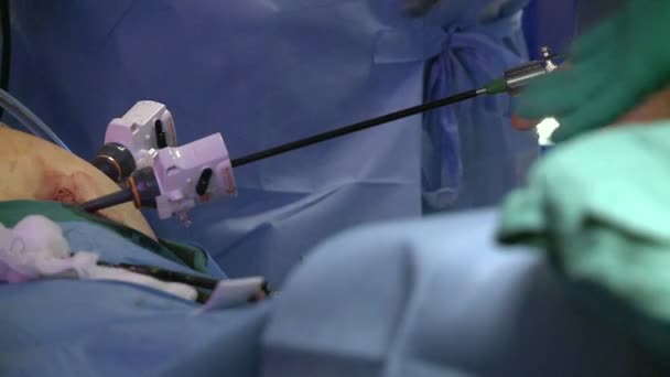 Surgeons performing a medical operation — Stock Video