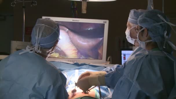 Surgeons performing robotic operation — Stock Video