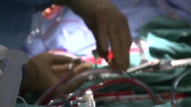 Хирурги, выполняющие медицинскую операцию — стоковое видео