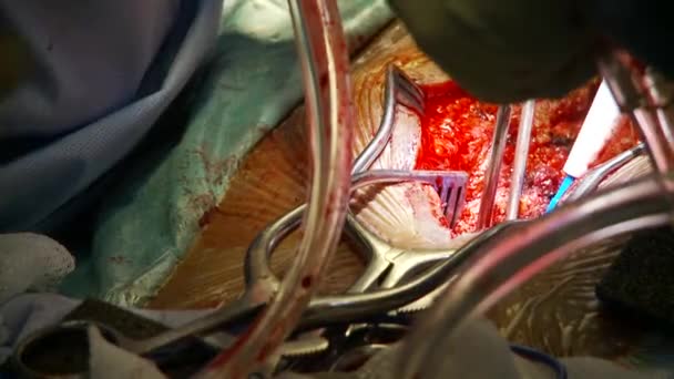 Belsejében egy tipikus Kórház sebészeti műtő views — Stock videók