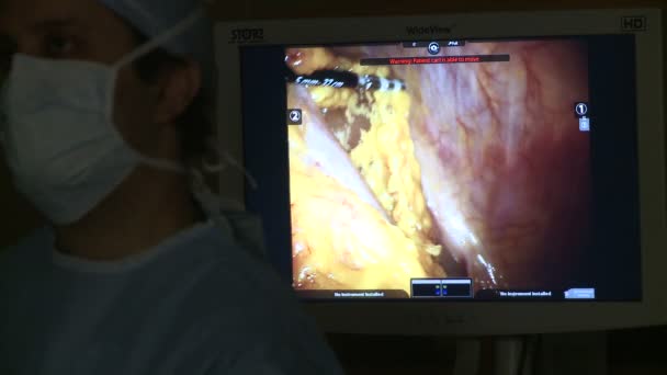 Cirugía robótica del útero — Vídeo de stock