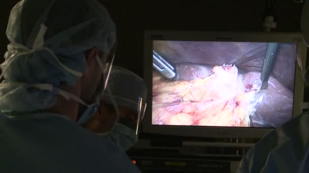 Monitor de vídeo utilizado durante la laparoscopia — Vídeos de Stock