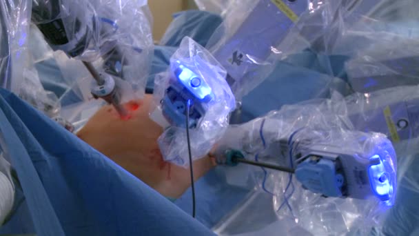 Veduta del lavoro all'interno di un'unità chirurgica robotica — Video Stock