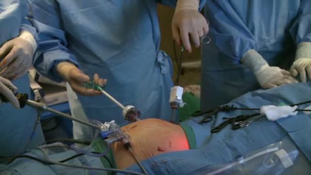 Chirurgiens mains pendant la chirurgie laparascopique — Video