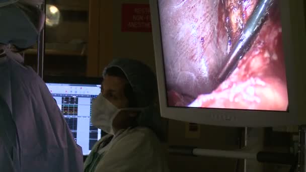 Monitor de vídeo usado durante a laparoscopia — Vídeo de Stock