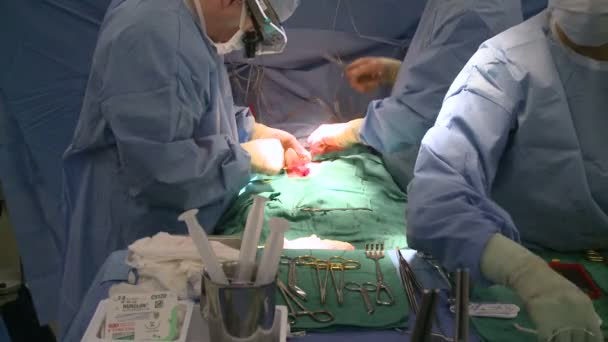 外科医生缝合腹部 — 图库视频影像