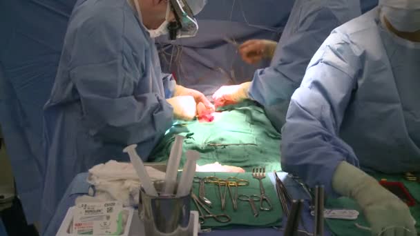 Surgeon stitching up abdomen — Stock Video