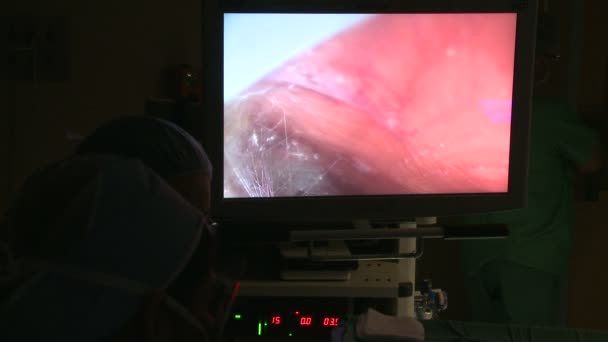 Laparoscopic camera moves into place — Stock Video