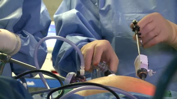 Surgeons performing a medical operation — Stock Video