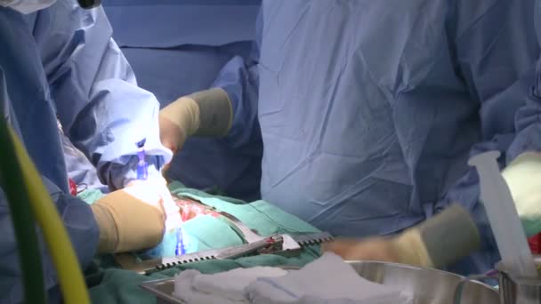 Surgeons performing a medical operation — Stock Video