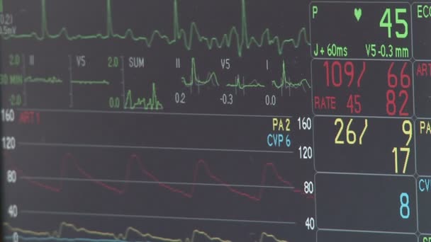 Monitor spårar vitala tecken — Stockvideo