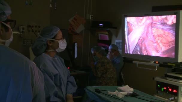 Video monitoru během laparoskopie — Stock video