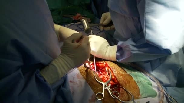 Vistas dentro de un quirófano quirúrgico típico del hospital — Vídeo de stock