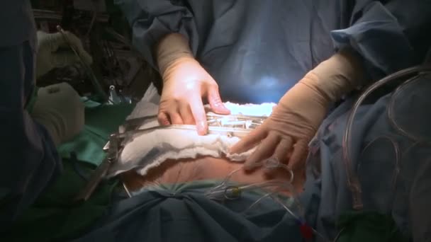 RIB OPROLMECHANISMEN gepositioneerd voor gebruik — Stockvideo