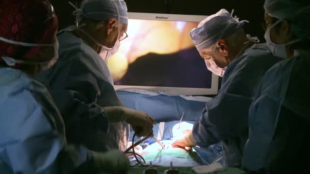 Équipe de chirurgiens effectuant la chirurgie — Video