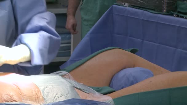 Paciente Preparado para Cirurgia — Vídeo de Stock