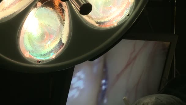 Хирурги, выполняющие медицинскую процедуру — стоковое видео
