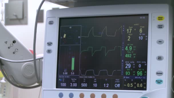 Medyczny monitor podczas zabiegu — Wideo stockowe