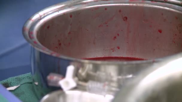 Sangue in bacino in ospedale — Video Stock