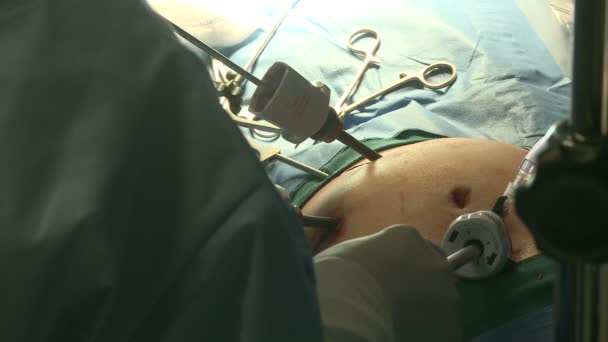 Chirurgiens effectuant l'opération — Video