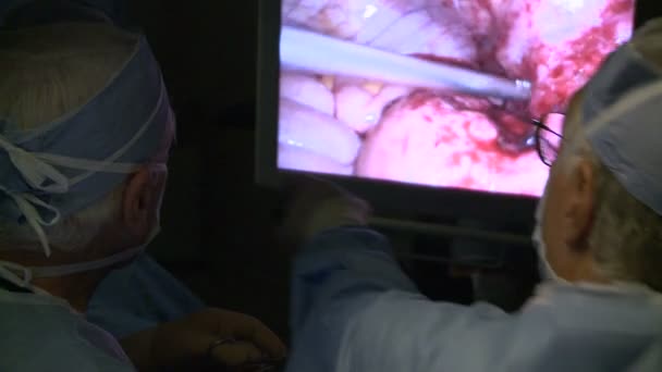 Cirurgiões no trabalho durante a apendicectomia laparoscópica — Vídeo de Stock