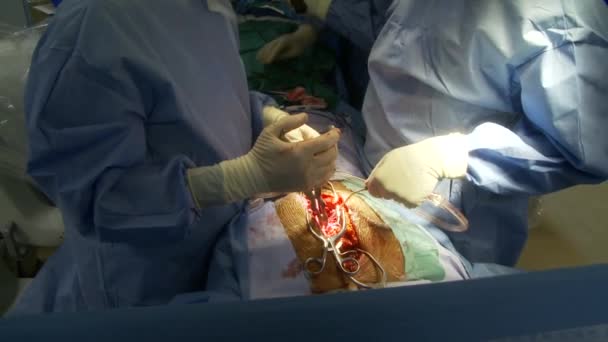 一个典型医院外科手术室里面的意见 — 图库视频影像
