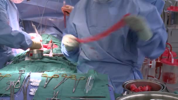 Инструментный стол во время операции — стоковое видео