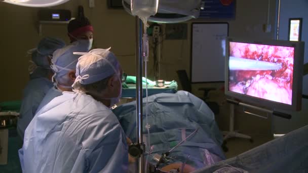 Kirurger som utför robotic — Stockvideo