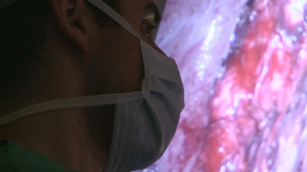 Kirurger som utför en medicinsk åtgärd i sjukhus — Stockvideo