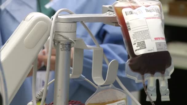 IV мешок антикоагулянта во время операции — стоковое видео