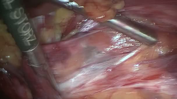 Хирурги проходят мимо тканей — стоковое видео